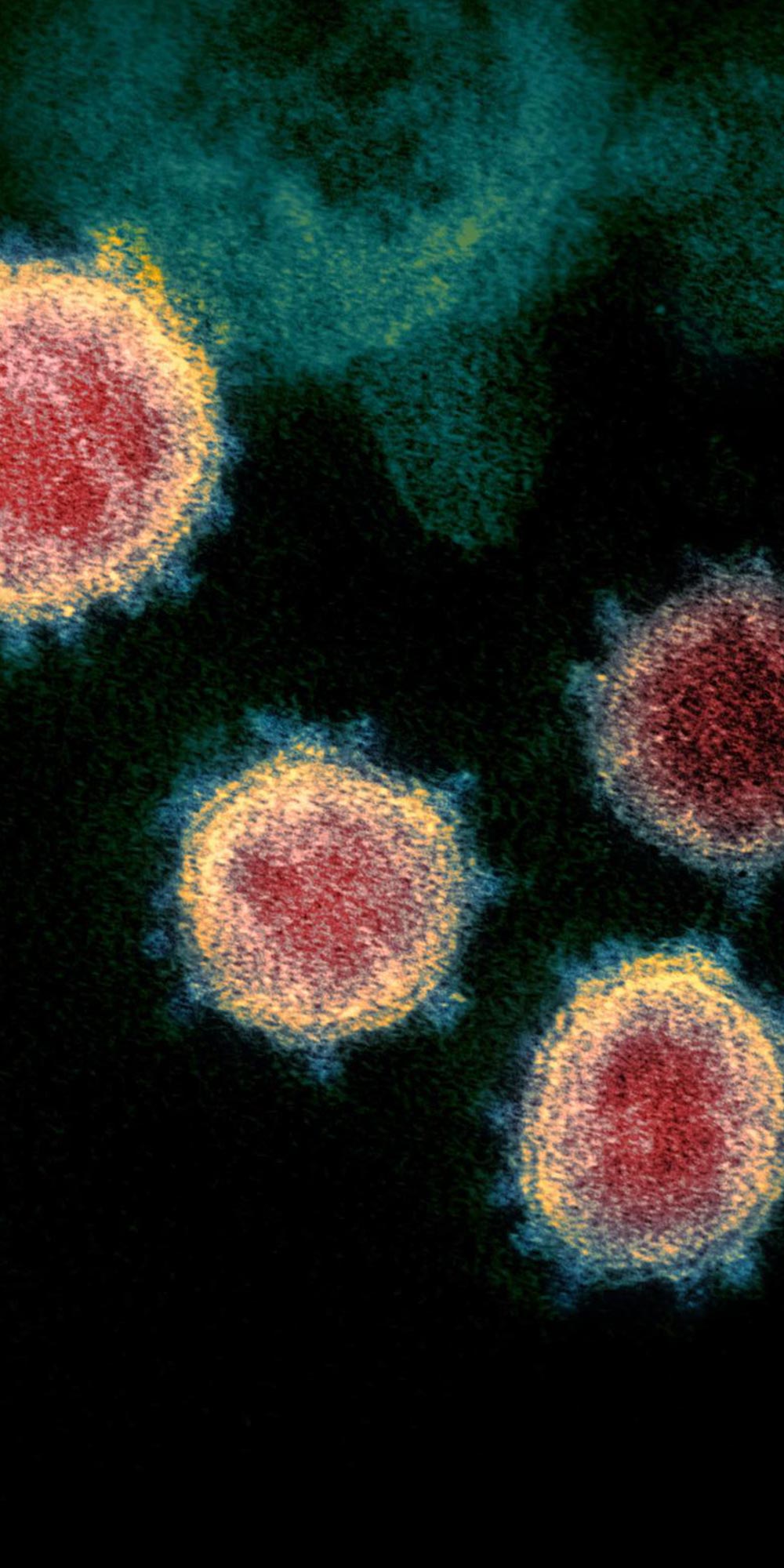 Cosa succederà dopo il Covid 19? Come sarà il mondo post Coronavirus?